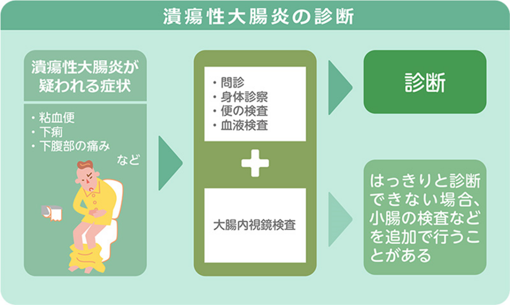 潰瘍性大腸炎の症状はどれくらい続きますか?