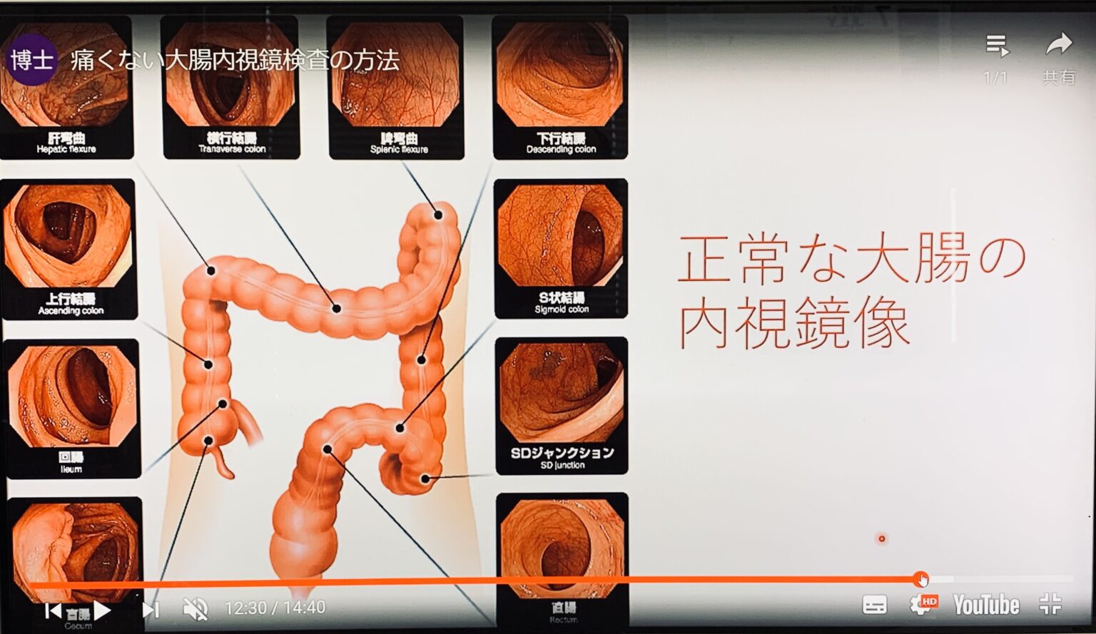 便秘X線検査とは何ですか？