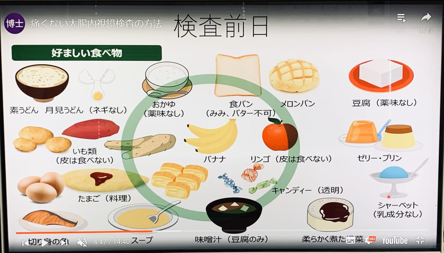 大腸内視鏡検査で期待できること